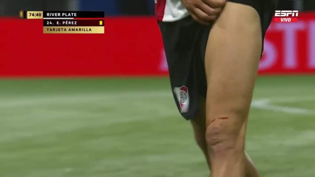 Enzo Pérez